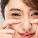 Tratament cu toxină botulinică pentru ridurile de pe nas „Bunny lines” - Doctor SKiN