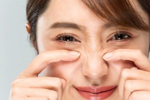 Tratament cu toxină botulinică pentru ridurile de pe nas „Bunny lines” - Doctor SKiN