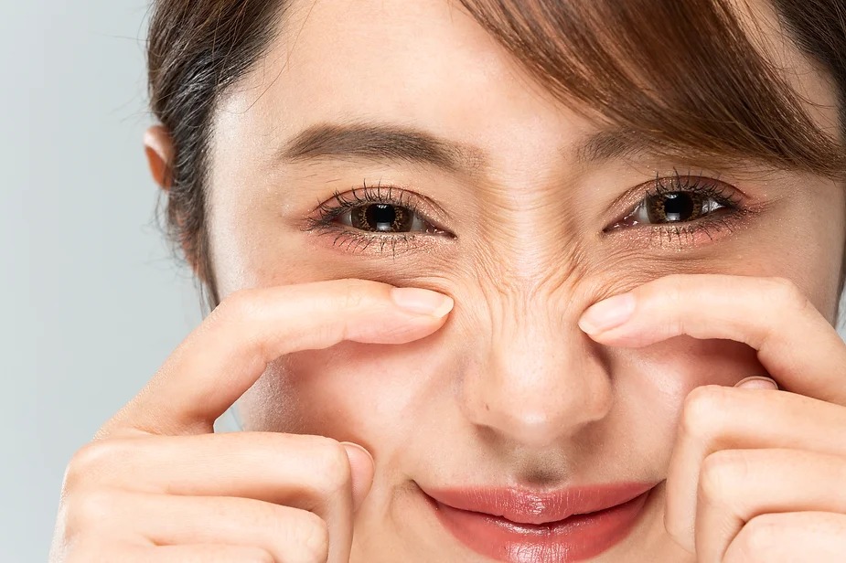 Tratament cu toxină botulinică pentru ridurile de pe nas „Bunny lines”