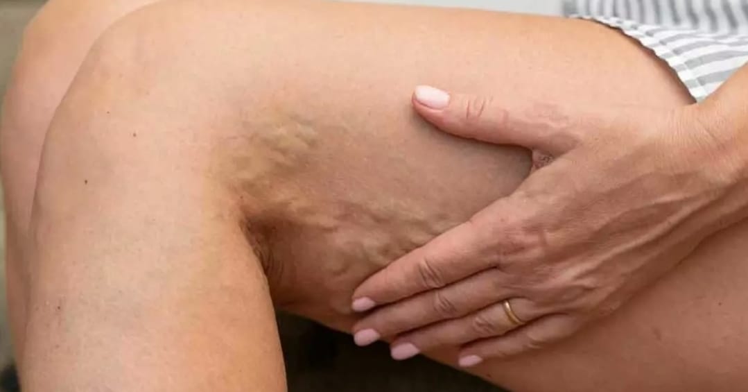 Glosar termeni - Doctor SKiN